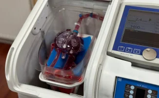 В Казахстане 137 человек ждут пересадки сердца: 30% не доживают до операции