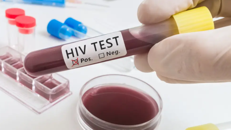 Пациент из Германии вылечился от ВИЧ: 5 лет без вируса