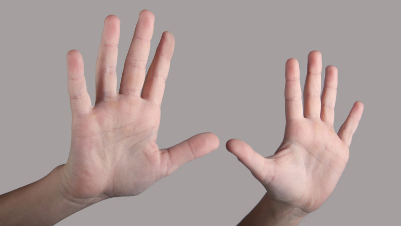 Врач развеял миф: хруст костяшками пальцев не вызывает артрит