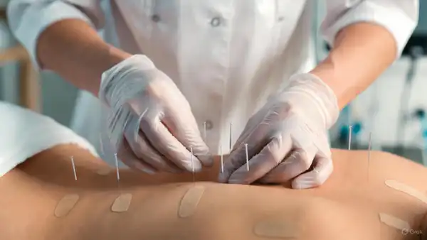 Неудачное иглоукалывание в санатории ВКО: пострадала женщина