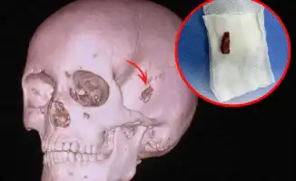 В Павлодаре у десятилетнего мальчика извлекли ветку из головы