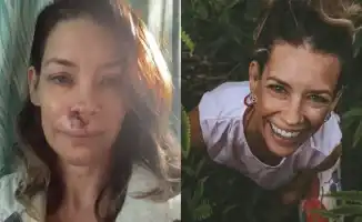 Эванджелин Лилли рассказала о травме мозга в начале 2026