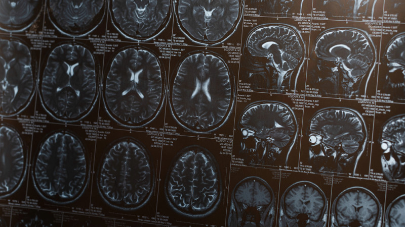 Чтение и изучение языков: привычки, снижающие риск деменции у пожилых людей на 40%