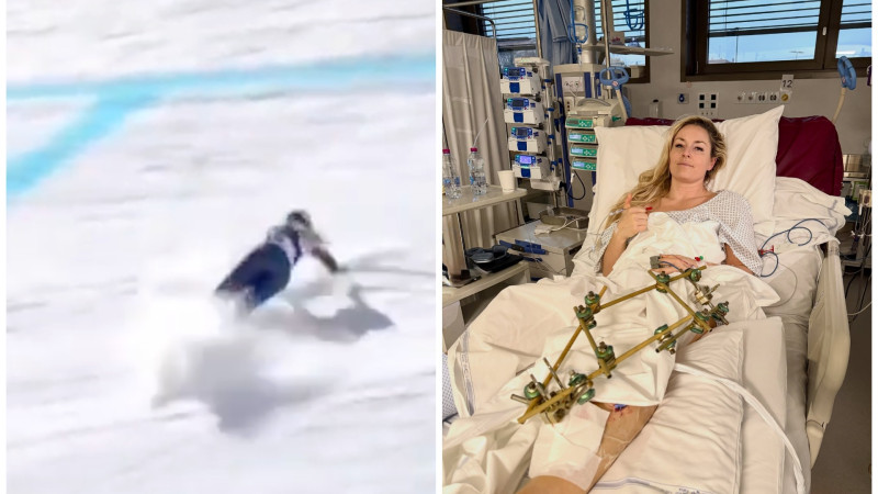 Линдси Вонн перенесла третью операцию после падения на Играх