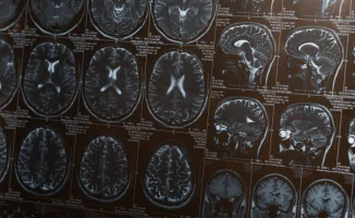 Чтение и изучение языков: привычки, снижающие риск деменции у пожилых людей на 40%