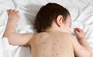 В Костанае детей с кишечной инфекцией перевели во взрослую больницу