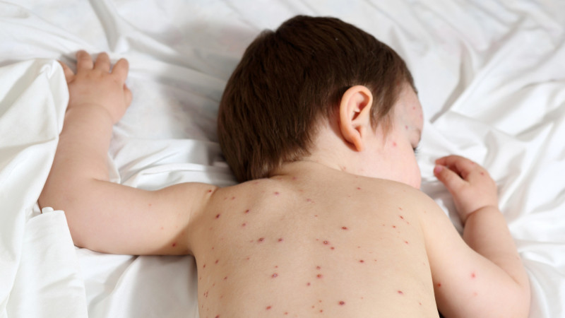 В Костанае детей с кишечной инфекцией перевели во взрослую больницу