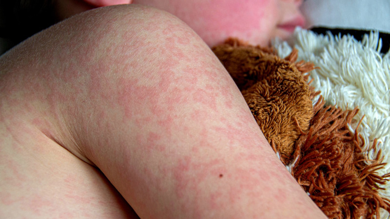 Рост кори в Алматы: ситуация остается напряженной по всей стране