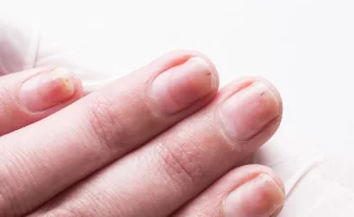 Врачи предупредили о симптомах рака, видимых невооружённым глазом